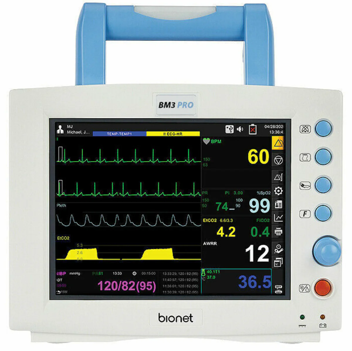 The Bionet BM3 PRO Multi-Parameter Patient Vital Signs Monitor.