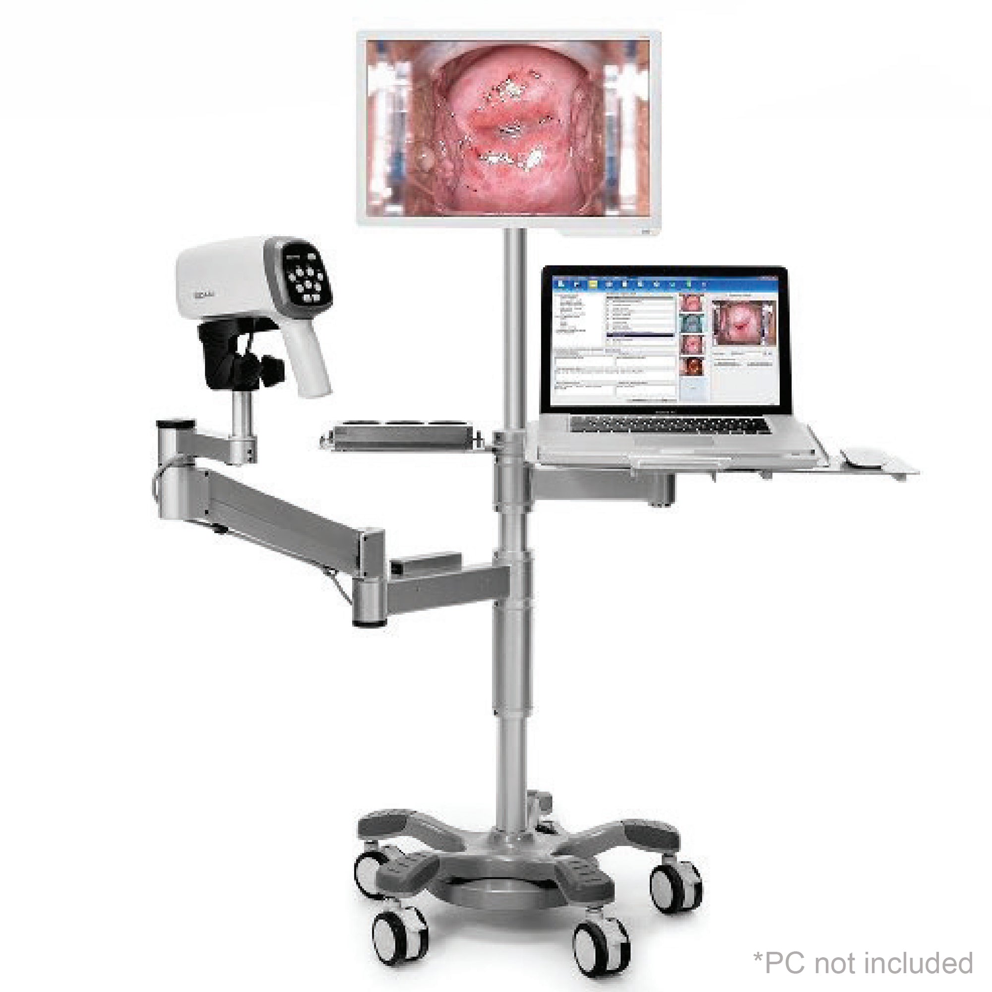 EDAN C6AHD_Arm_Tray_Monitor Colposcope