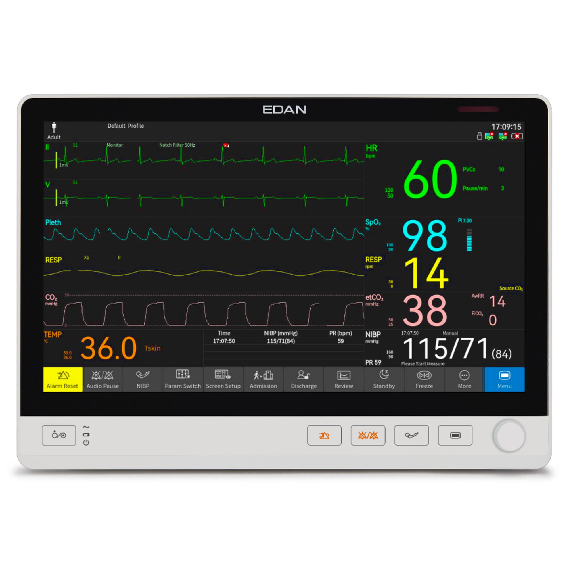 EDAN UX12 Vital Signs Monitor