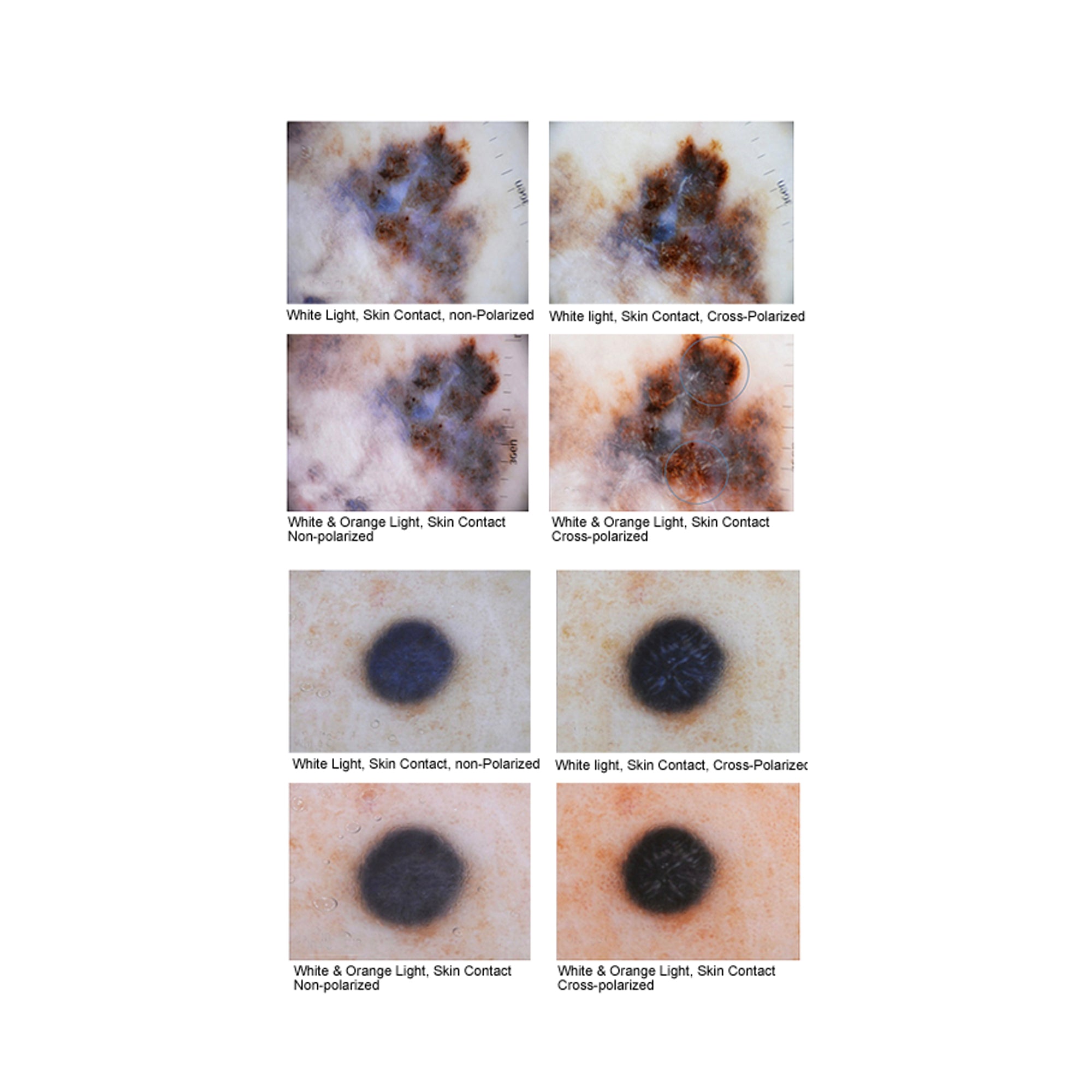 DermLite® DL4™ Portable Dermatoscope