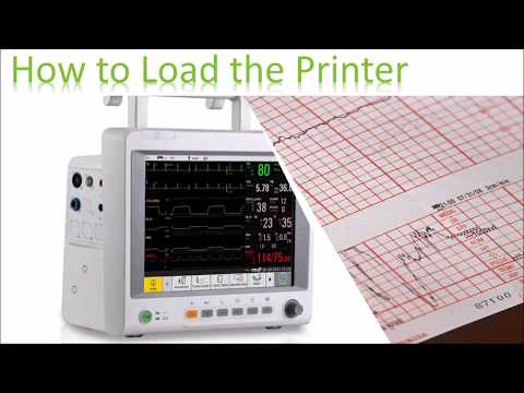 Edan_Thermal_Printer_for_IM3-Vital_Signs_Monitor
