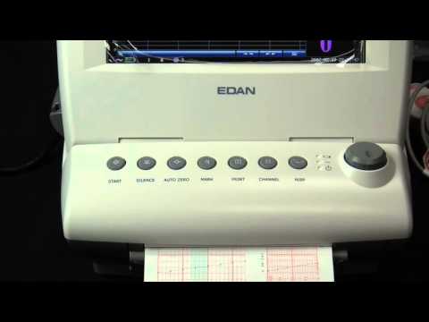 edan f6 fetal heart rate monitor