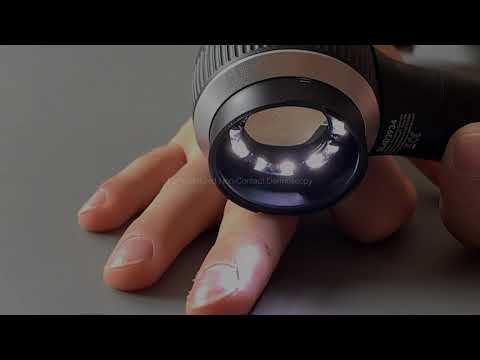 Dermlite® DL4™ Portable Dermatoscope