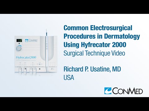 Conmed-7-900-115-Hyfrecator-2000-ESU