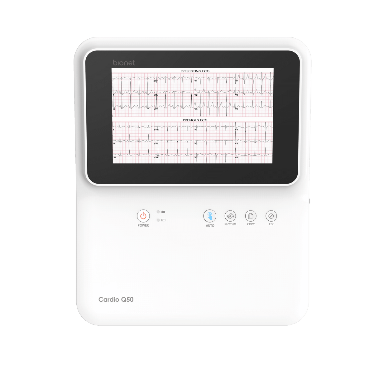 Bionet Cardio Q50 ECG 8 inch capacitive touch screen top view