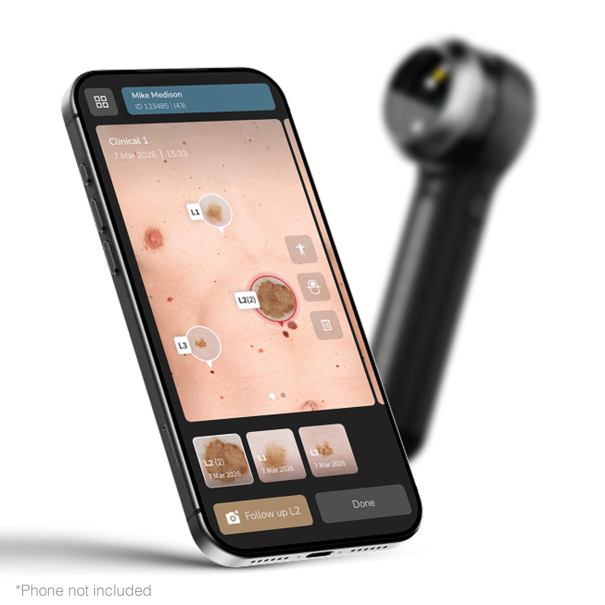 Dermlite DL5 PLUS Pocket Dermatoscope DL5P