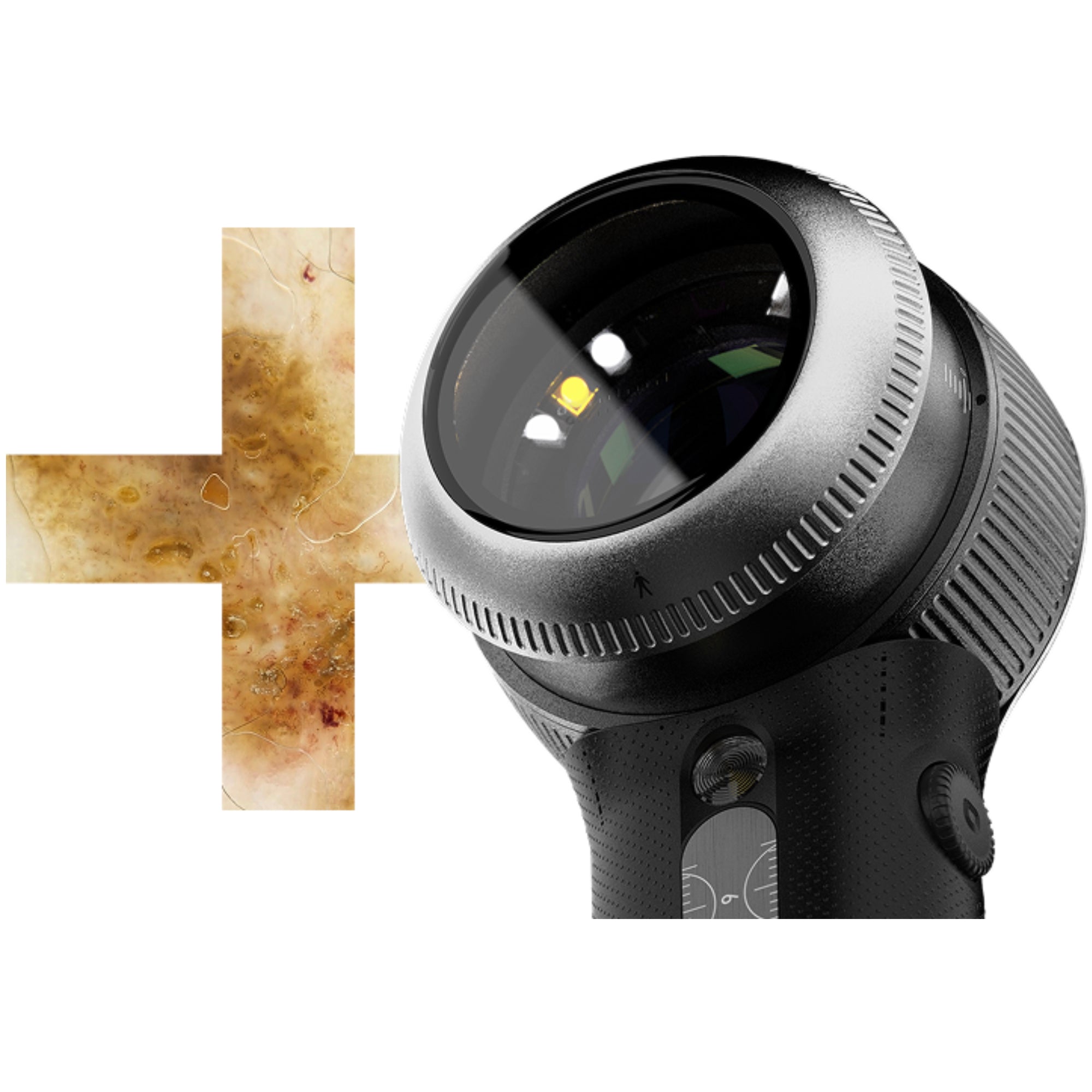 Dermlite DL5 PLUS Pocket Dermatoscope DL5P