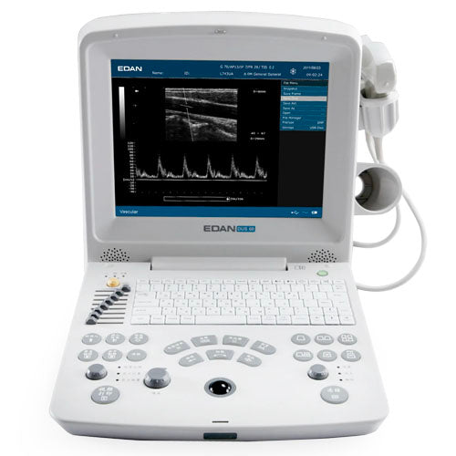 EDAN-DUS 60-Ultrasound-Machine-Brand New