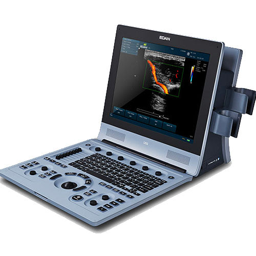 EDAN-U60-Ultrasound-Imaging-System