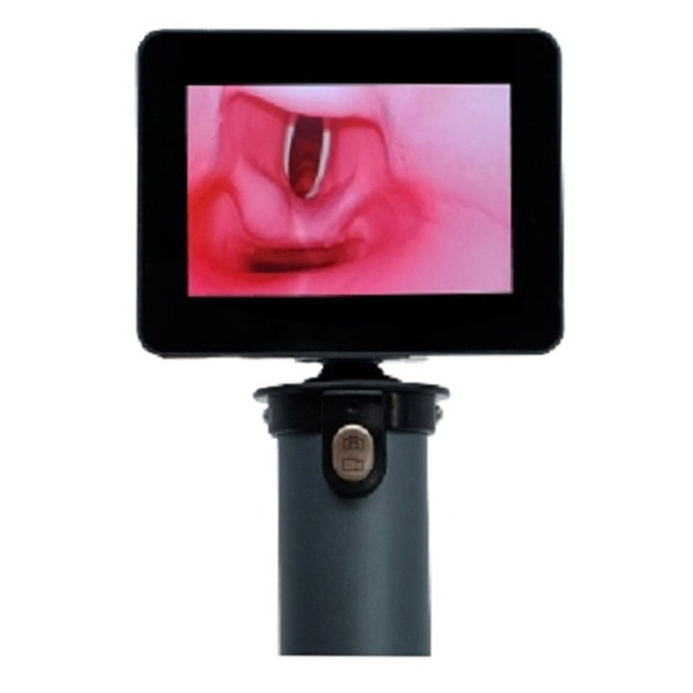 MD Pro EZ Vision™ Video Laryngoscope w/3" LCD Display