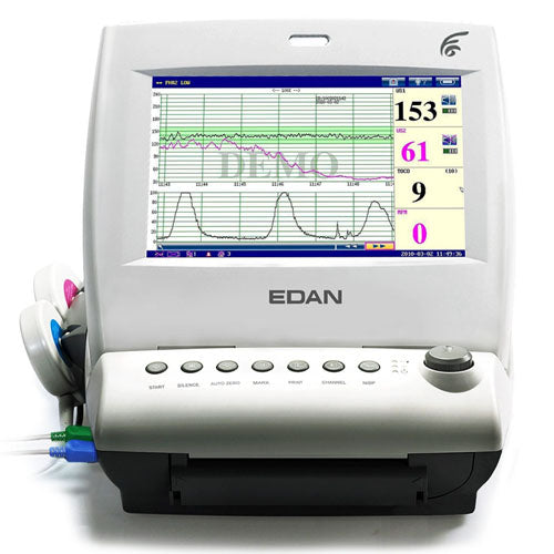 edan f6 fetal heart rate monitor