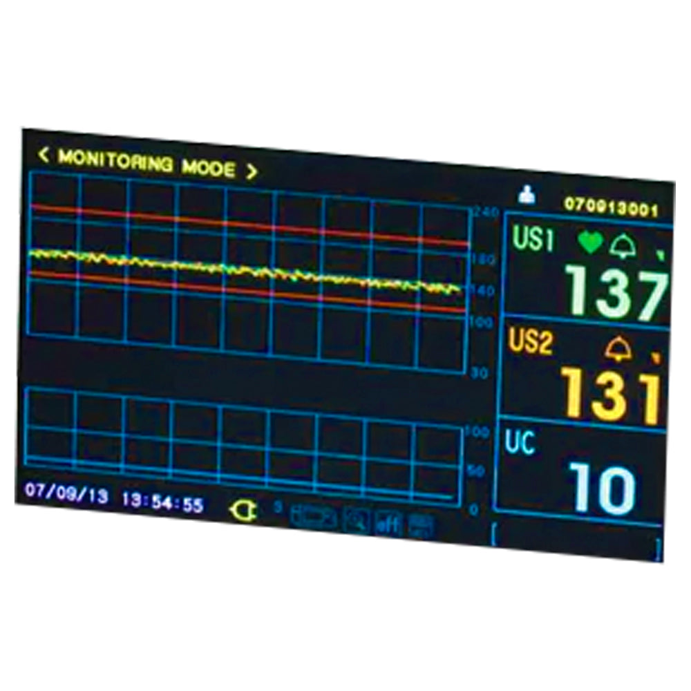 Bistos Replacement LCD Display for BT-350L FHR Monitor, BT-LCD350L - MedLabAmerica.com
