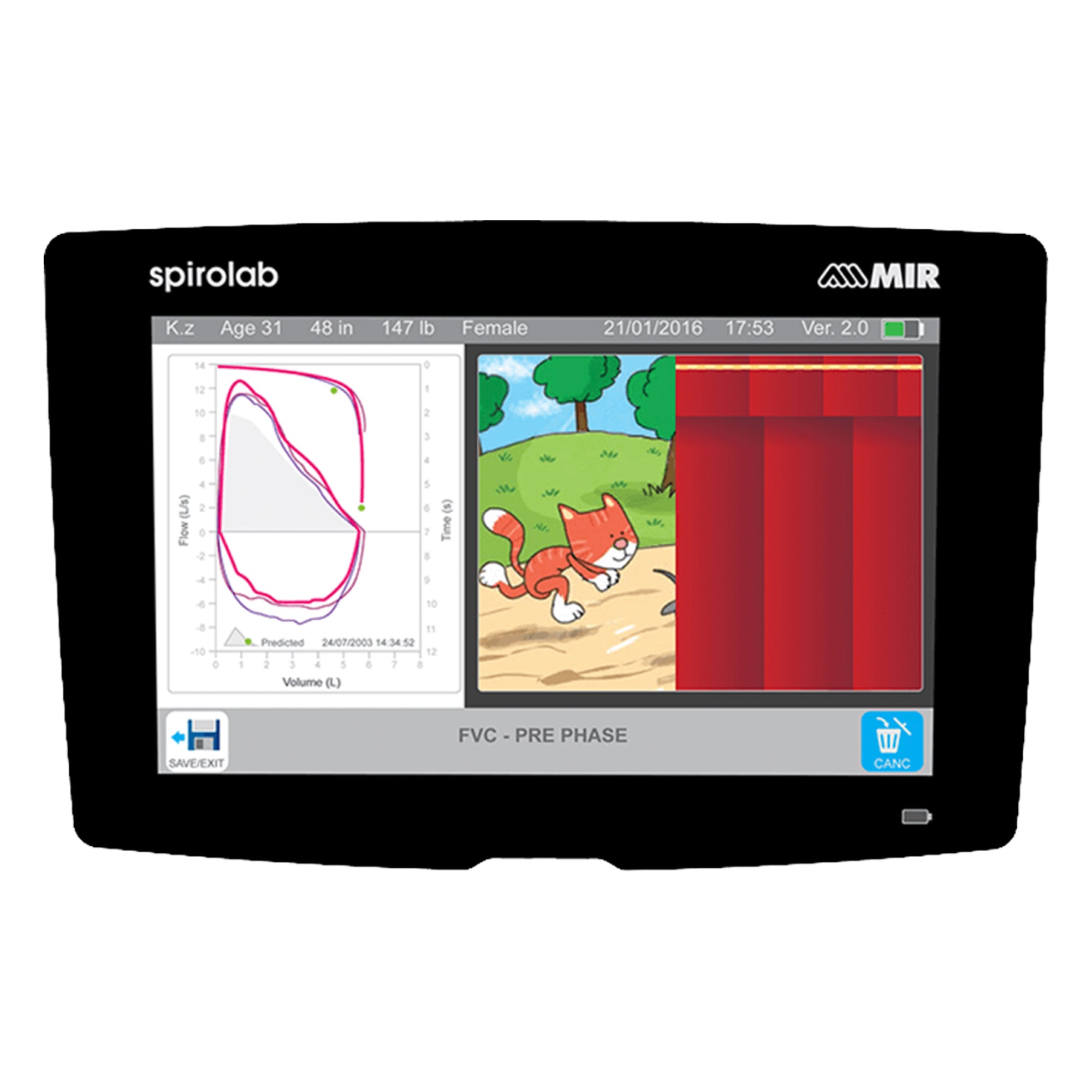 Mir Spirolab Desktop Spirometer 911080